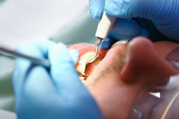 Best Dentist for Tooth Abscess  in Windsor, NC